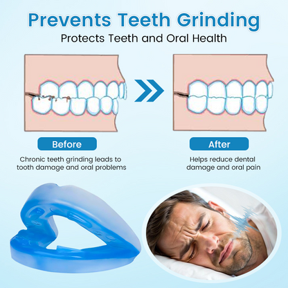 LAST DAY SALE 60% OFF⏰PerfectSleep Solution- Anti-Snoring & Anti-Grinding Teeth Protector